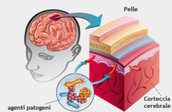 Meningite: Che Sintomi Ha? Come Si Cura? È Contagiosa? Ecco Tutto Ciò ...