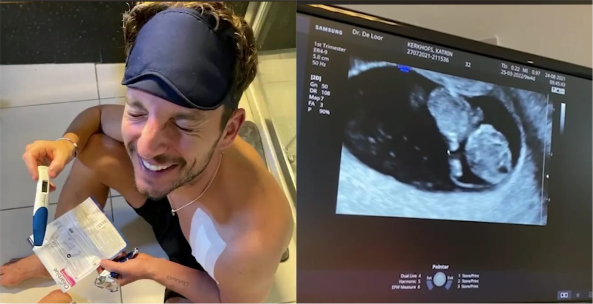 Dries Mertens e sua moglie Kat aspettano un figlio l annuncio social